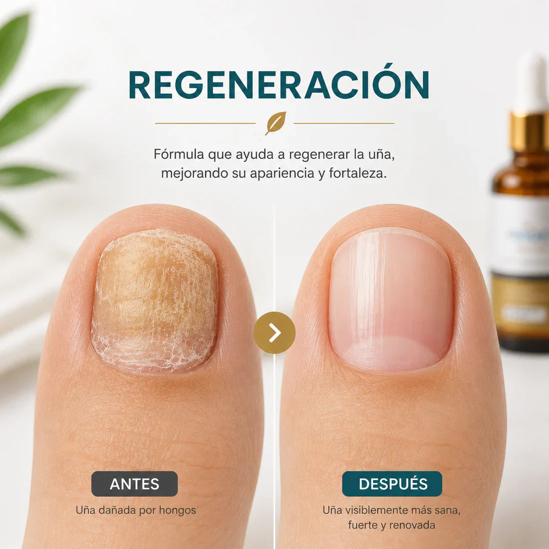 Finger Solution